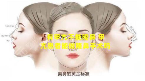 有甲亢不能隆鼻 甲亢患者能做隆鼻手术吗